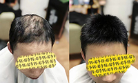 重慶各類(lèi)無(wú)痕接發(fā)定制