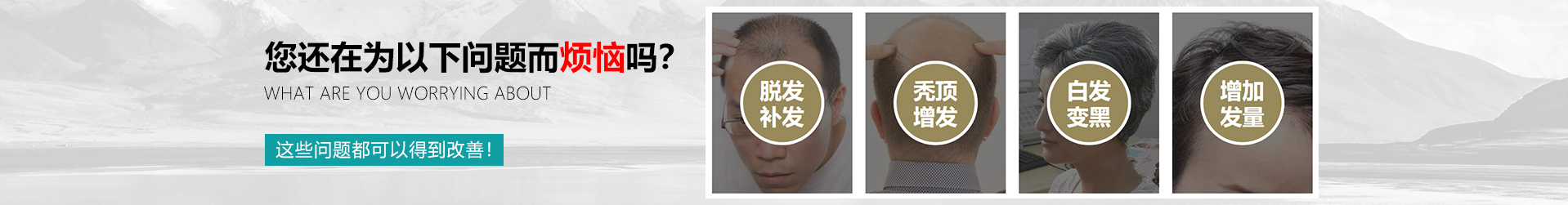 重慶男士假發(fā)定制