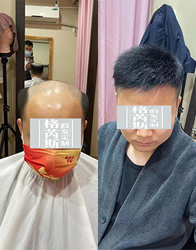 制作好后，根據(jù)您的頭型量身剪裁，設(shè)計(jì)您喜歡的發(fā)型