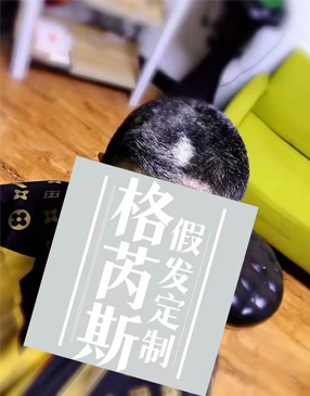 織發(fā)補(bǔ)發(fā)