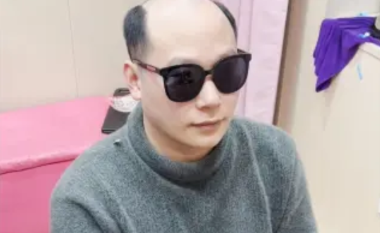 定制假發(fā)的意義在于符合自己的審美、穿搭、年齡